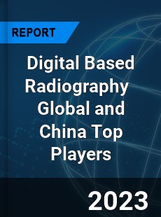 Digital Based Radiography Global and China Top Players Market