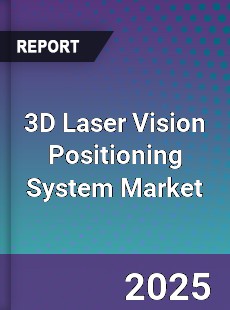 Global 3D Laser Vision Positioning System Industry
