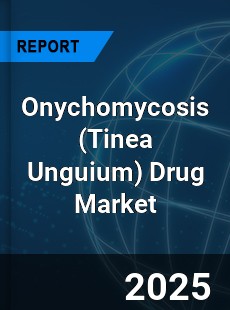 Global Onychomycosis Drug Market