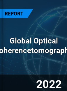 Global Optical Coherencetomography Market