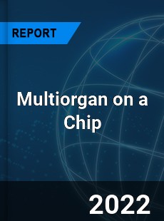 Multiorgan on a Chip Market